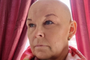 Porträtt av en kvinna utan hår. Hon intervjuas i artikeln om sin cancer.