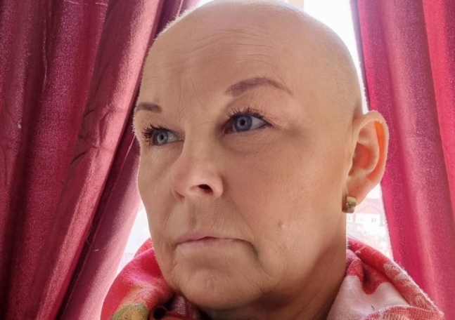 Porträtt av en kvinna utan hår. Hon intervjuas i artikeln om sin cancer.